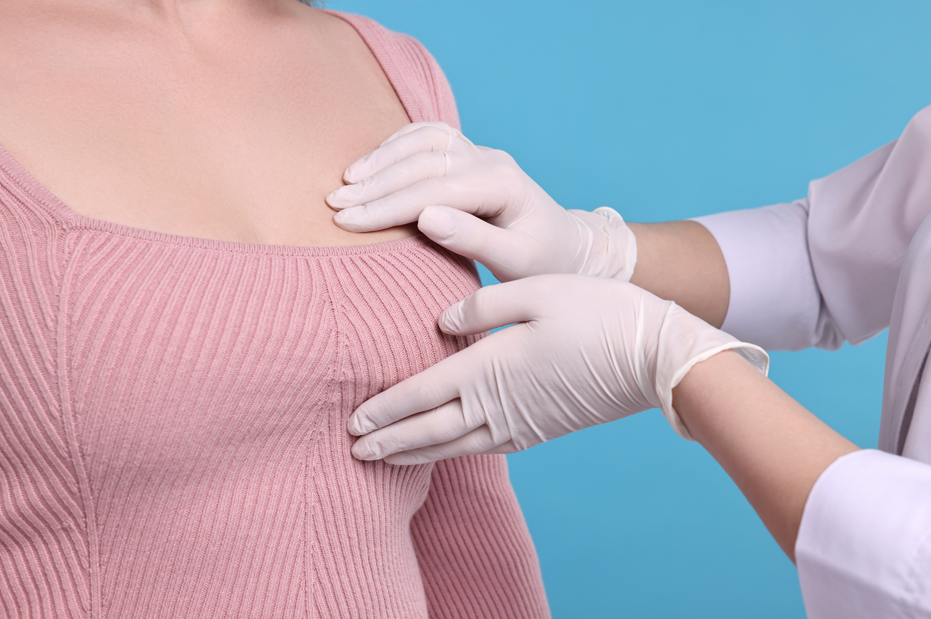 Estudo brasileiro mostra baixa taxa de reoperação após cirurgia conservadora da mama